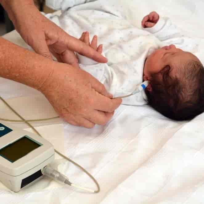 غربالگری شنوایی بدو تولد نوزادان